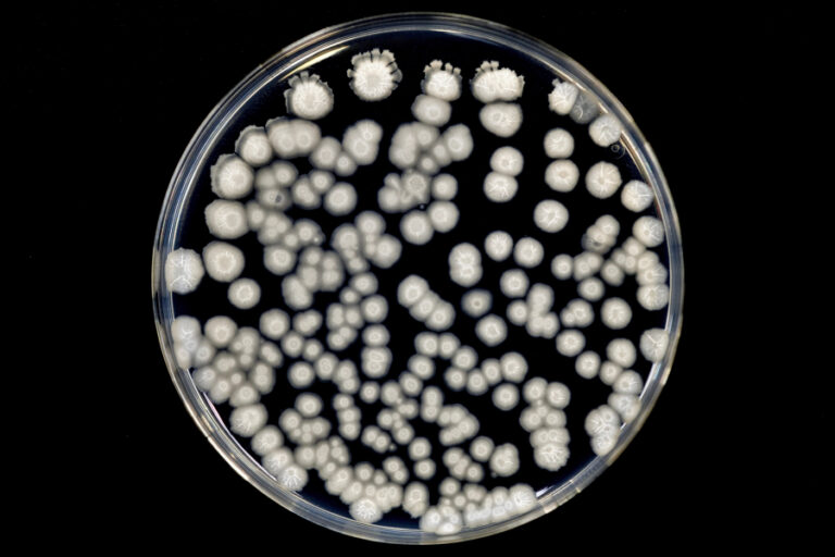 Aplicación Tamaño de partículas Banner - Paralab distribuye equipo de particle size en España.