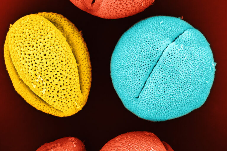 Aplicación Morfología Banner - Paralab distribuye equipo de morphology en España.