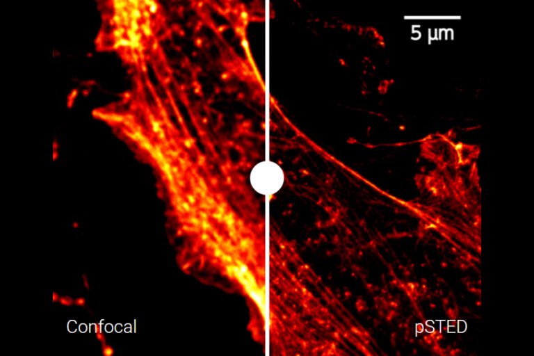 Técnica Microscopía Banner - Paralab distribuye equipo de microscope en España.